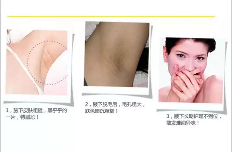 Natural Fruit Extract Armpit Whitening Cream 100% Safe Formula Armpit Whitening Cream Legs Knee Exfoliating Private Parts Care